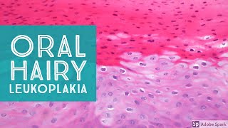 WHAT IS HAIRY LEUKOPLAKIA Oral Hairy Leukoplakia Symptoms Causes Diagnosis Treatment [upl. by Windzer]