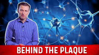 What is Plaque and How to Remove it Explained By Dr Berg [upl. by Hattie]