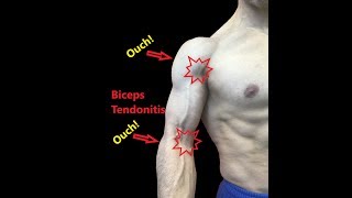 Biceps Tendonitis Treatment At Home Relieve Pain Fast [upl. by Odragde]