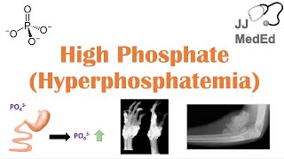 High Phosphate Hyperphosphatemia Dietary Sources Causes Symptoms Treatment [upl. by Erdied]