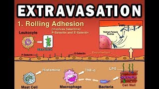 EXTRAVASATION [upl. by Melly]