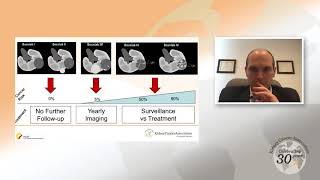 Small Renal Masses An Overview [upl. by Ettenay]