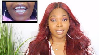 How To Close Gap Teeth Without Braces In 45 Mins  My Dental Bonding Experience [upl. by Kantos]