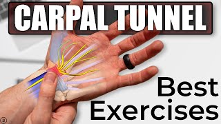 Ultrasound guided carpal tunnel syndrome injection by Murat Karkucak MD [upl. by Colb811]