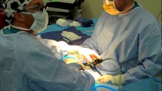 Endoscopic Carpal Tunnel Release  Middlesex Hospital [upl. by Cullie]