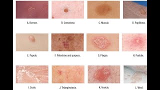 Skin Lesions with defination [upl. by Lander]